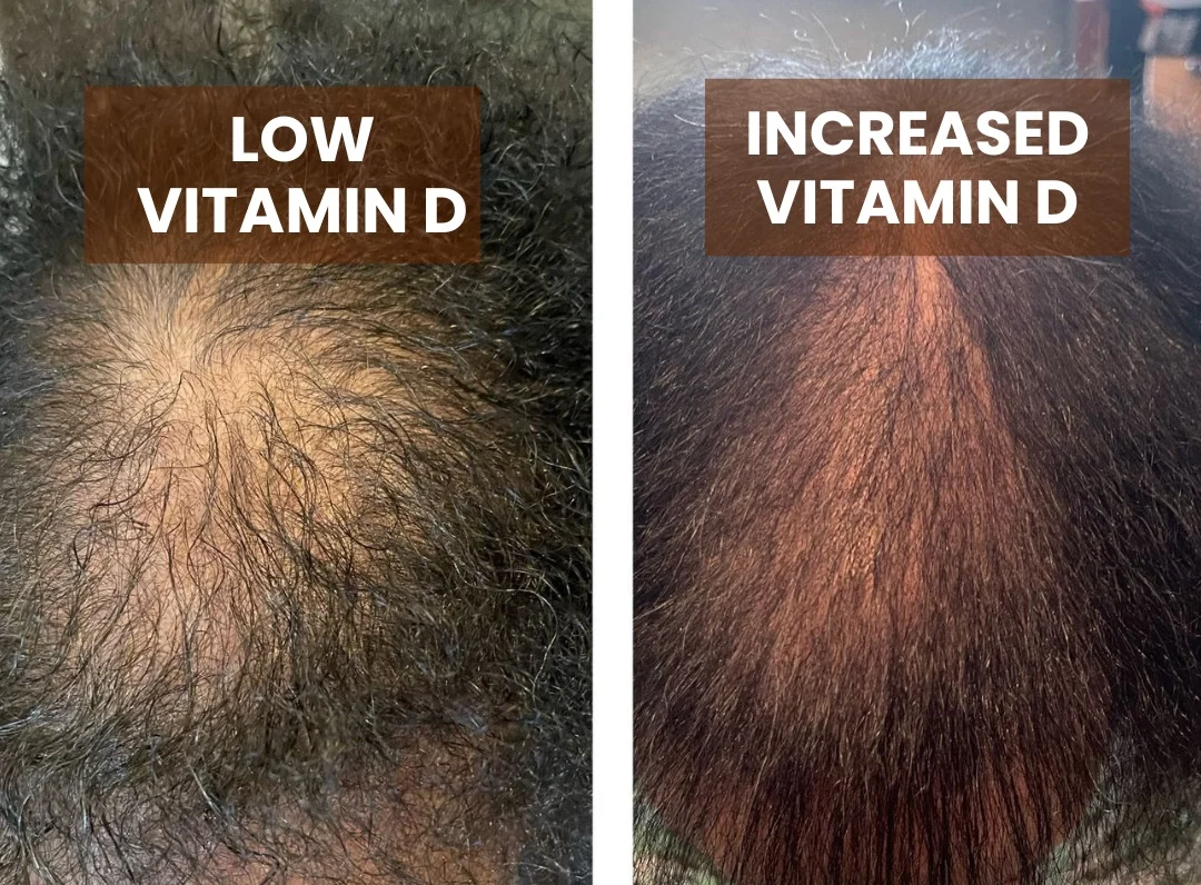 Vitamin D3 & K2 - Image 5